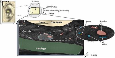 High-Resolution Episcopic Imaging for Visualization of Dermal Arteries and Nerves of the Auricular Cymba Conchae in Humans